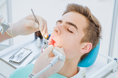 Simi Valley Dental Fillings