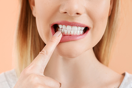 Periodontal Treatment Simi Valley